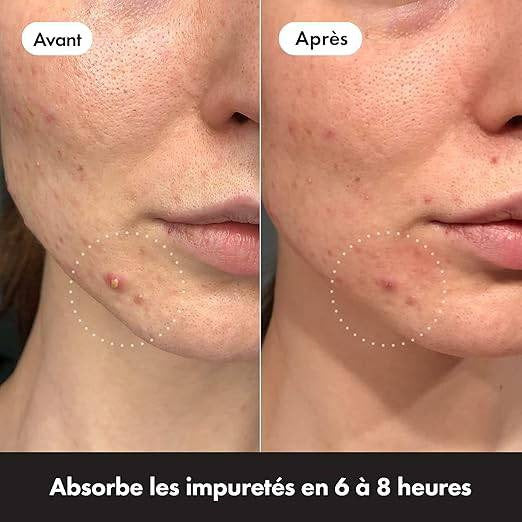 Mighty Patch Original