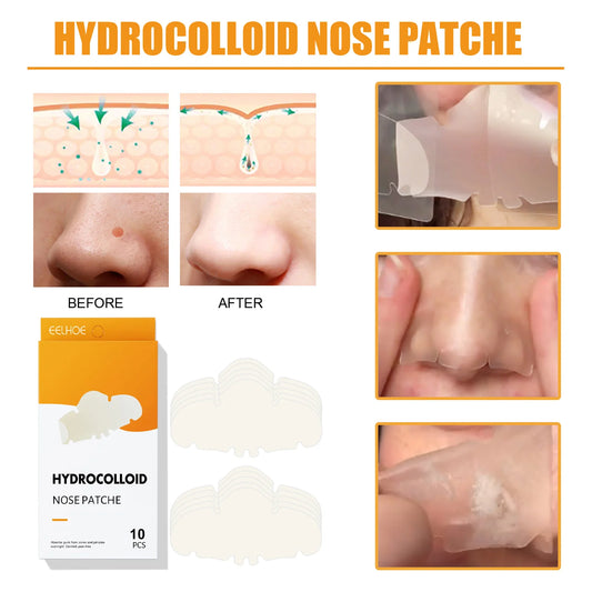 Pimple Patches Hydrocolloid Patches T-Zone Pore Patch Forehead Nose and Chin Hydrocolloid Patch for Blackheads A-Cne and Oily
